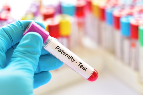 Can I Refuse a Paternity Test?